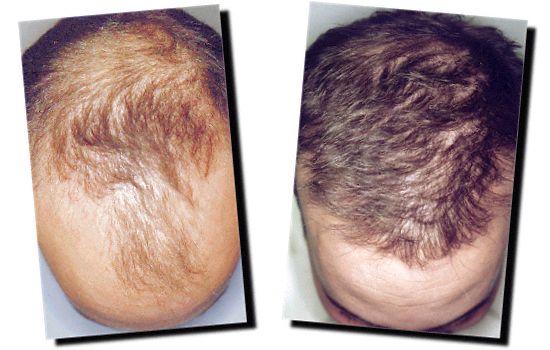 Ad:  x.jpg
Gsterim: 5578
Boyut:  37.7 KB