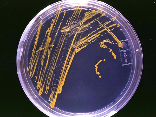 Ad: Agar_plate_with_colonies.jpg
Gösterim: 204
Boyut: 53.7 KB