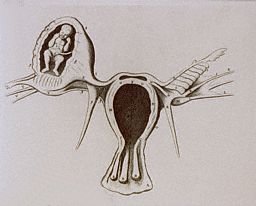 Ad: ektopik.jpg
Gösterim: 601
Boyut: 10.8 KB