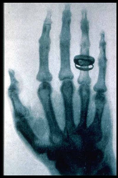 Ad: 400px-Roentgen-x-ray-von-kollikers-hand.jpg
Gösterim: 3578
Boyut: 44.3 KB