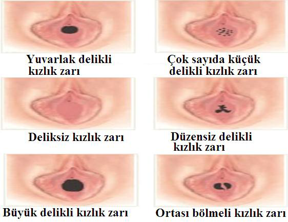 Ad:  reme2.png
Gsterim: 42246
Boyut:  273.2 KB