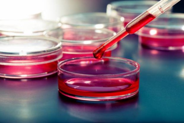 Ad: petri kabı2.jpg
Gösterim: 274
Boyut: 36.3 KB