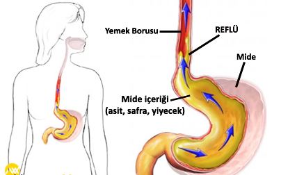 Ad:  refl.jpg
Gsterim: 9264
Boyut:  23.6 KB