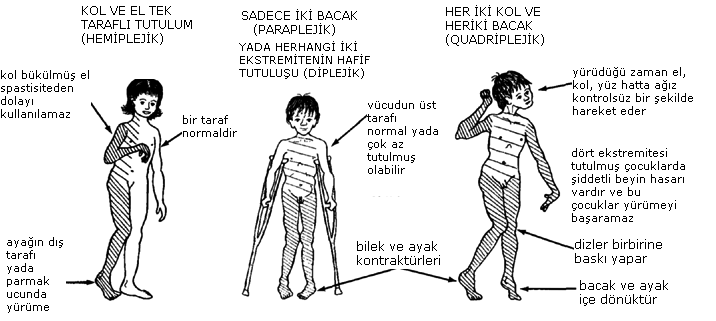 Ad: serebral.gif
Gösterim: 2194
Boyut: 38.5 KB