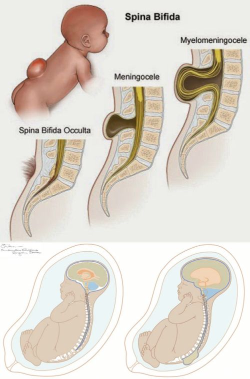 Ad: spb2.jpg
Gösterim: 5350
Boyut: 46.4 KB