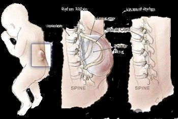 Ad: sb1.jpg
Gösterim: 3567
Boyut: 18.1 KB