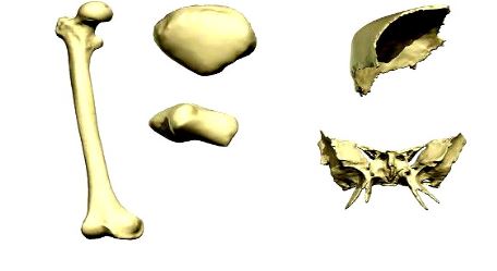 Ad:  kem6.JPG
Gsterim: 9357
Boyut:  19.7 KB