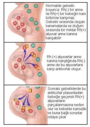 Ad:  kan11.JPG
Gsterim: 31881
Boyut:  39.0 KB