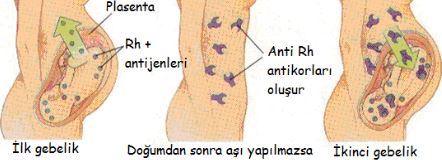 48706d1462893232 kan gruplari ve kan grubu uyumlari kangrup2 - 0 rh pozitif ve 0 rh negatif evlenebilir mi? 48706d1462893232 kan gruplari ve kan grubu uyumlari kangrup2