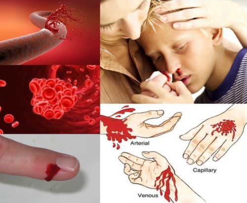 Ad:  kanamas.jpg
Gsterim: 2404
Boyut:  37.0 KB