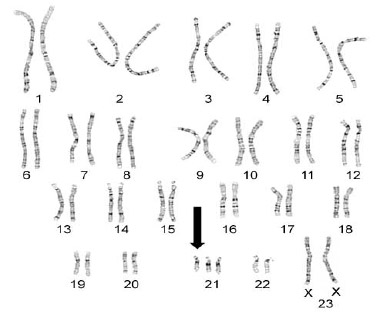 Ad: 3.jpg
Gösterim: 20445
Boyut: 21.2 KB