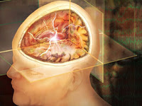 Ad:  4.jpg
Gsterim: 216
Boyut:  12.7 KB