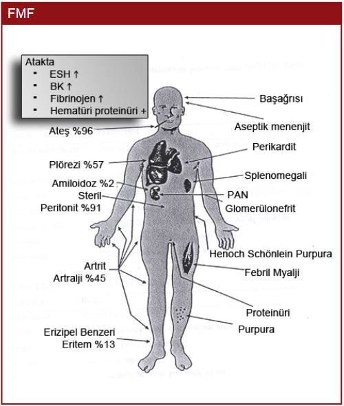 Ad: fmf2.JPG
Gösterim: 3006
Boyut: 53.5 KB