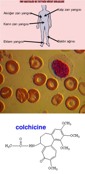 Ad: Ailevi Akdeniz Ateşi (Fmf)1.jpg
Gösterim: 2898
Boyut: 33.7 KB
