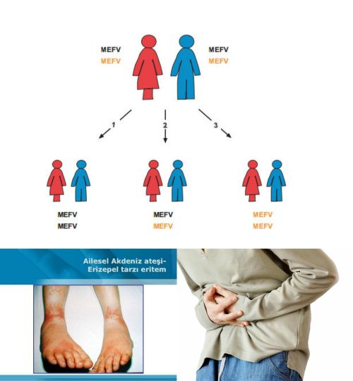 Ad: Ailevi Akdeniz Ateşi (Fmf)4.jpg
Gösterim: 3167
Boyut: 28.6 KB