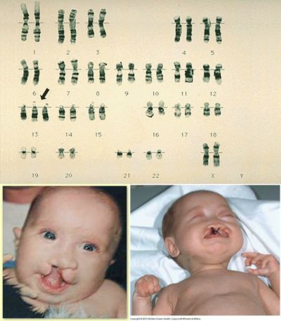 Ad: patau s.jpg
Gösterim: 6150
Boyut: 29.6 KB