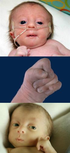 Ad: 18 trizomi1.jpg
Gösterim: 4794
Boyut: 16.3 KB