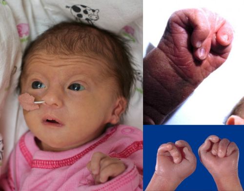 Ad: 18trizomi2.jpg
Gösterim: 9715
Boyut: 28.6 KB