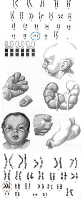 Ad: trizomi.jpg
Gösterim: 2890
Boyut: 30.7 KB