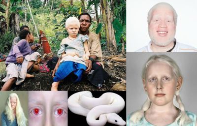 Ad:  albinizm3.jpg
Gsterim: 714
Boyut:  27.5 KB