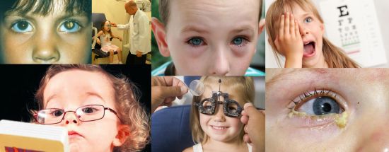 Ad:  ocuklarda gz hastalklar.jpg
Gsterim: 2323
Boyut:  24.4 KB