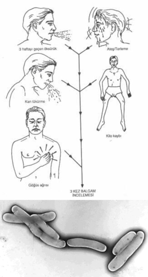 Ad:  verem5.jpg
Gsterim: 3071
Boyut:  46.1 KB