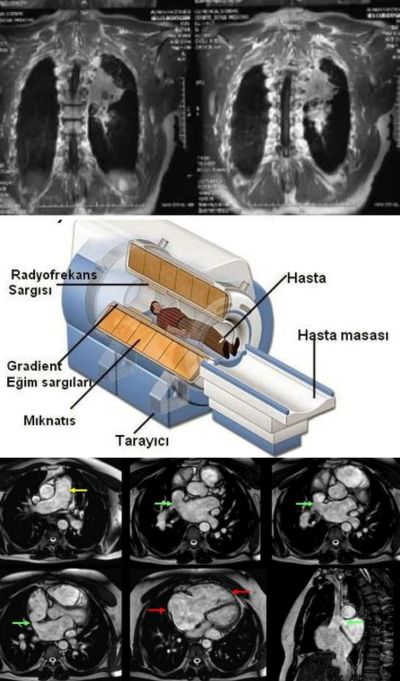 Ad:  gr4.jpg
Gsterim: 2330
Boyut:  55.1 KB