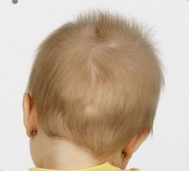 Ad: boyun eğriliği.jpg
Gösterim: 1278
Boyut: 65.0 KB