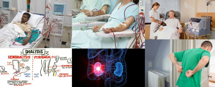 Ad:  Bbrek Yetmezlii ve Tedavi eitleri.jpg
Gsterim: 2457
Boyut:  45.1 KB