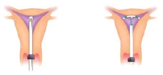 Ad:  aplan4.JPG
Gsterim: 8777
Boyut:  16.2 KB