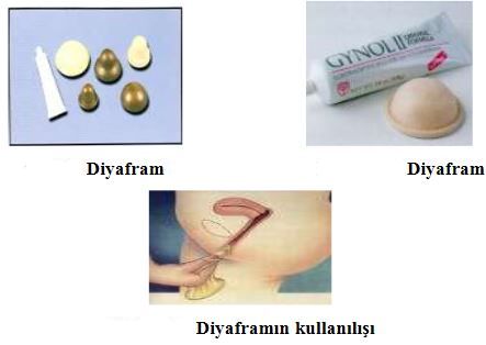 Ad:  aplan5.JPG
Gsterim: 9113
Boyut:  21.5 KB