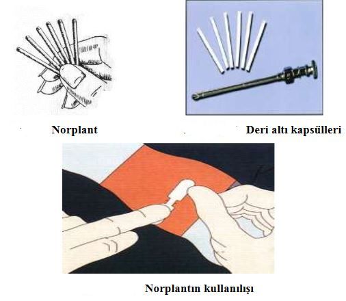 Ad:  aplan6.JPG
Gsterim: 8481
Boyut:  34.8 KB