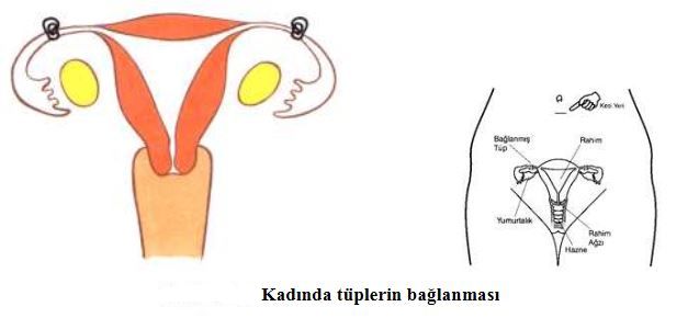 Al�nt�daki Ek 52334