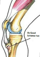 Ad: os good hastaligi.jpg
Gösterim: 661
Boyut: 28.7 KB