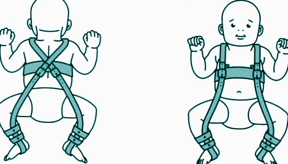 Ad: kalça çığı tedavisi.jpg
Gösterim: 786
Boyut: 115.3 KB