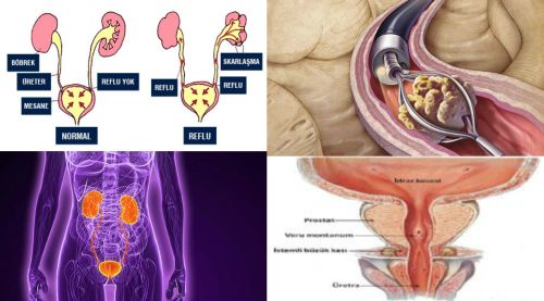 Ad:  uroloji.jpg
Gsterim: 7959
Boyut:  30.4 KB