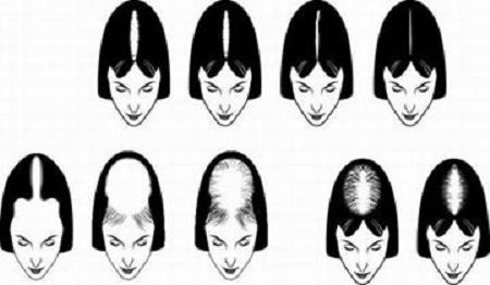 Ad:  genetik-sac-hastaliklari.jpg
Gsterim: 1284
Boyut:  49.4 KB