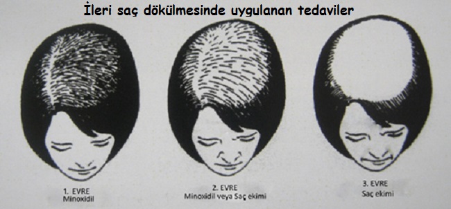 Ad:  sa sorunlar.jpg
Gsterim: 1454
Boyut:  62.4 KB