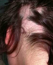 Ad:  alopesi.jpg
Gsterim: 3353
Boyut:  47.7 KB