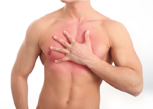 Ad:  jinekomasti (1).jpg
Gsterim: 3605
Boyut:  34.2 KB