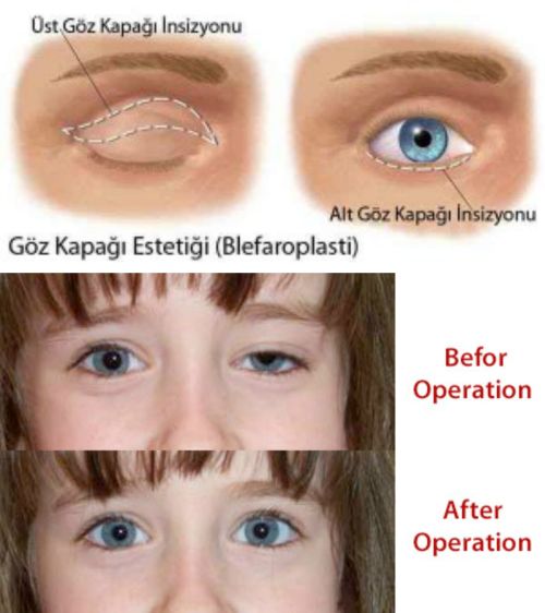 Ad:  ptoz.jpg
Gsterim: 16356
Boyut:  36.5 KB