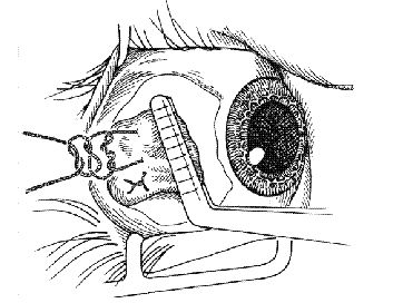 52957d1468693630 sasilik sasilik2