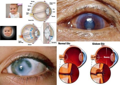 Ad:  glokome.jpg
Gsterim: 2777
Boyut:  37.7 KB