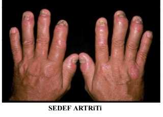 Ad:  2.JPG
Gsterim: 2665
Boyut:  8.0 KB