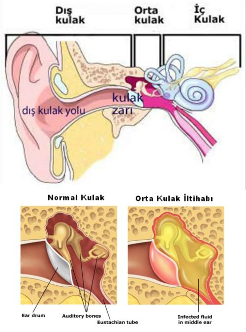 Ad: otitis.jpg
Gösterim: 4727
Boyut: 52.1 KB Ad: otitis.jpg
Gösterim: 4727
Boyut: 52.1 KB