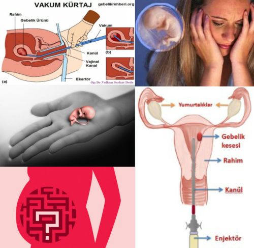 Ad:  krtaj.jpg
Gsterim: 4487
Boyut:  38.5 KB