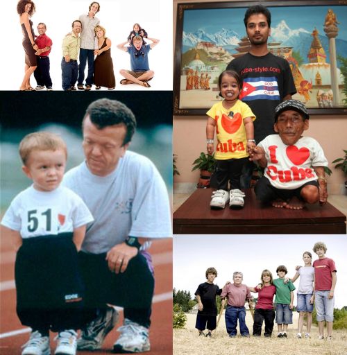 Ad:  Akondroplazi3.jpg
Gsterim: 2906
Boyut:  53.8 KB