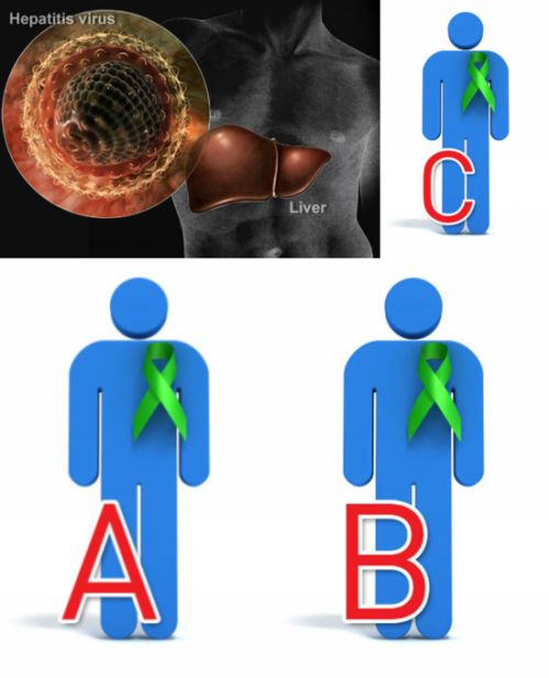 Ad:  hepatit1.jpg
Gsterim: 951
Boyut:  34.3 KB