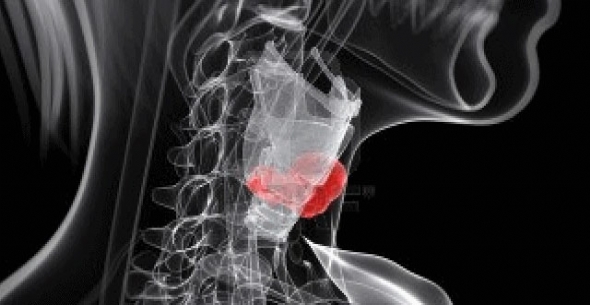 Ad: Gırtlak Kanseri.jpg
Gösterim: 2265
Boyut: 88.9 KB