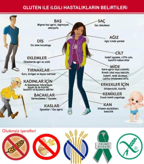 Ad:  lyak1.jpg
Gsterim: 22016
Boyut:  57.1 KB